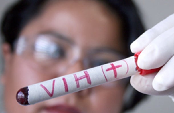 Científicos españoles logran que por primera vez cinco infectados con VIH controlen el virus sin medicamentos Científicos españoles logran que por primera vez cinco infectados con VIH controlen el virus sin medicamentos