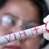 Muestra de VIH en un laboratorio