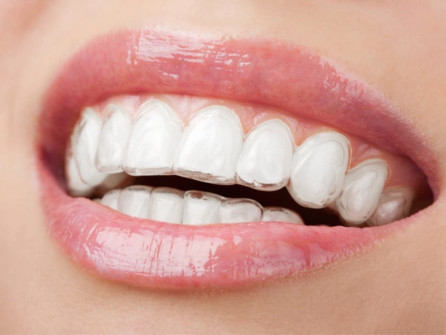 30ytantos: Las arrugas de los dientes 30ytantos: Las arrugas de los dientes