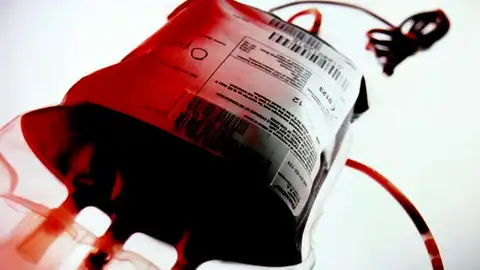 Una bolsa de plasma sanguineo Una bolsa de plasma sanguineo
