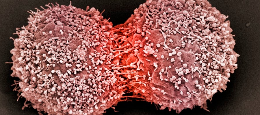 Descubren que la quimioterapia podría generar células cancerígenas Descubren que la quimioterapia podría generar células cancerígenas