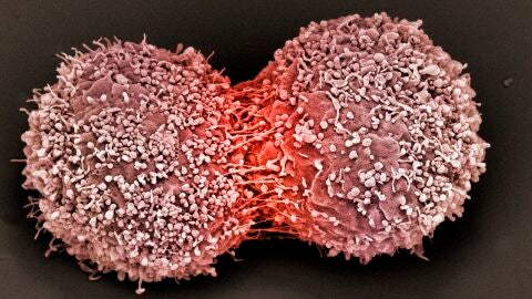 Descubren que la quimioterapia podr&iacute;a generar c&eacute;lulas cancer&iacute;genas 