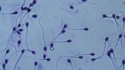 Espermatozoides en el microscopio.