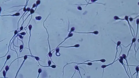 Espermatozoides en el microscopio. Espermatozoides en el microscopio.