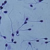 Espermatozoides en el microscopio.