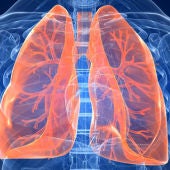 La fibrosis pulmonar