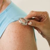 El número de lunares del brazo puede alertar de cáncer de piel