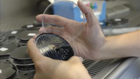 Una muestra recogida en unas torres de refrigeraci&oacute;n es analizada en un laboratorio