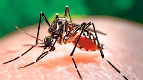 Se confirma que un recién nacido en Hawái con daño cerebral estaba infectado del virus Zika Se confirma que un recién nacido en Hawái con daño cerebral estaba infectado del virus Zika