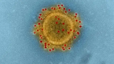 Imagen microscópica del virus MERS - CoV Imagen microscópica del virus MERS - CoV