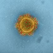 Imagen microscópica del virus MERS - CoV 