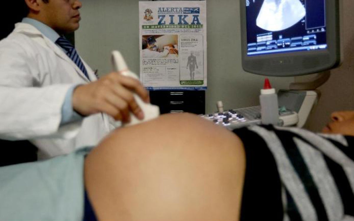 Sanidad eleva a 88 los casos del Zika en España, 11 de los cuales son mujeres embarazadas Sanidad eleva a 88 los casos del Zika en España, 11 de los cuales son mujeres embarazadas