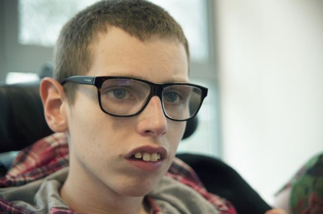 El joven británico que ha podido decir 'mamá' por primera vez a los 16 años El joven británico que ha podido decir 'mamá' por primera vez a los 16 años