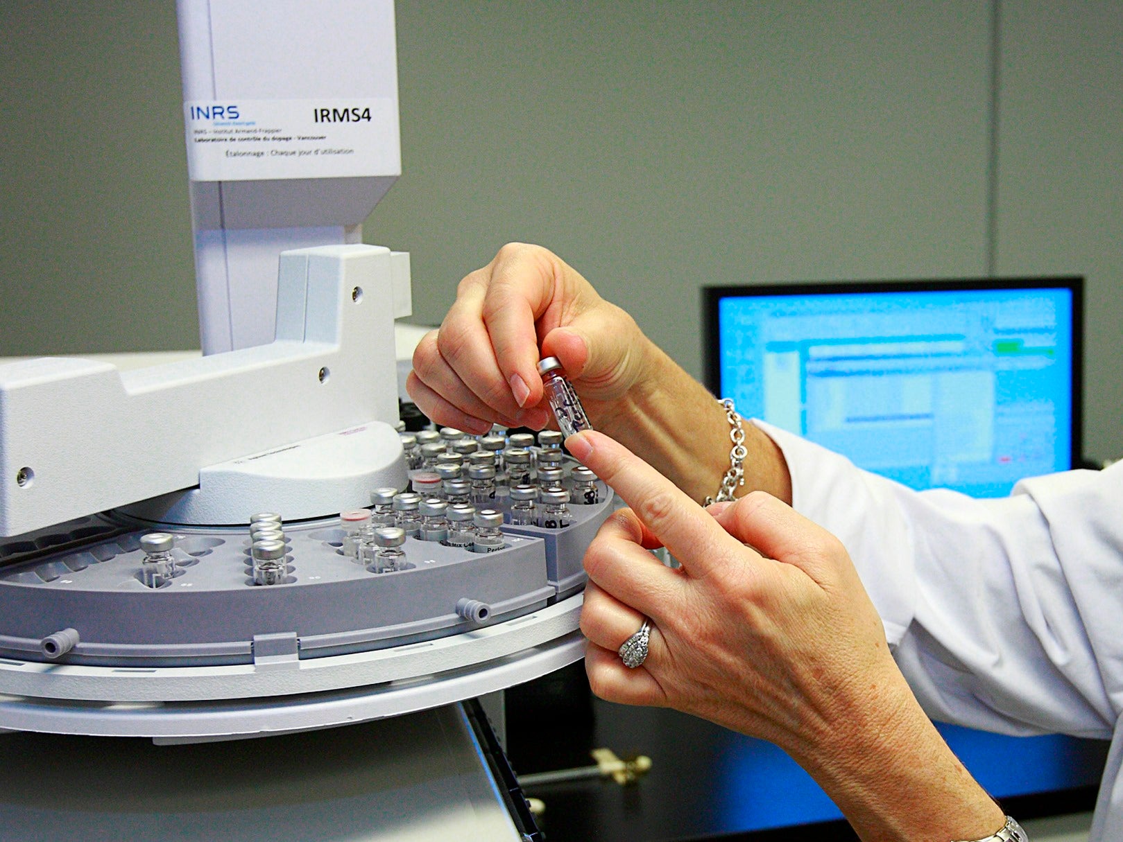 El CSIC desarrolla un biosensor capaz de detectar el VIH solo una semana después de la infección El CSIC desarrolla un biosensor capaz de detectar el VIH solo una semana después de la infección