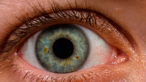 Un ojo azul Un ojo azul