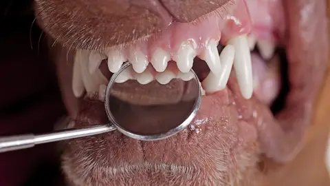 Dientes de perro Dientes de perro