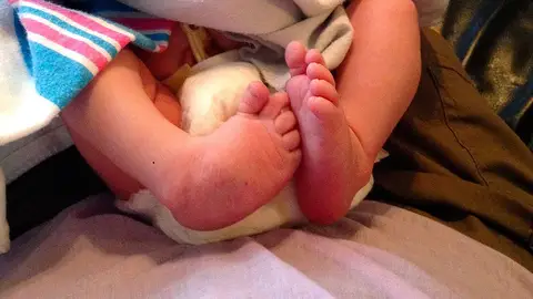 Imagen de los pies de un recién nacido Imagen de los pies de un recién nacido