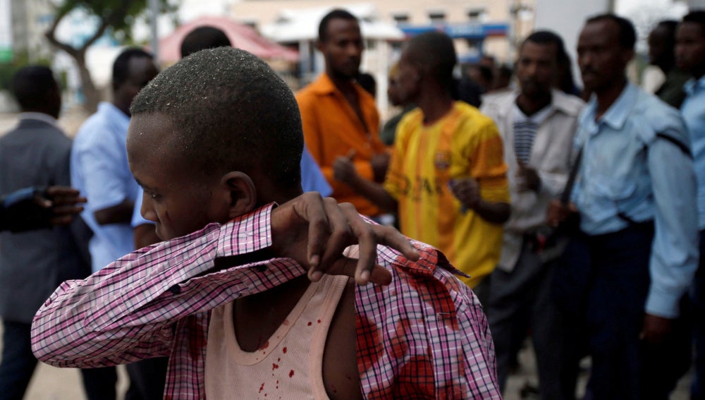 Heridos en el ataque terrorista en Mogadiscio