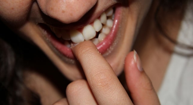 30ytantos: ¿Qué es la sonrisa gingival? 30ytantos: ¿Qué es la sonrisa gingival?