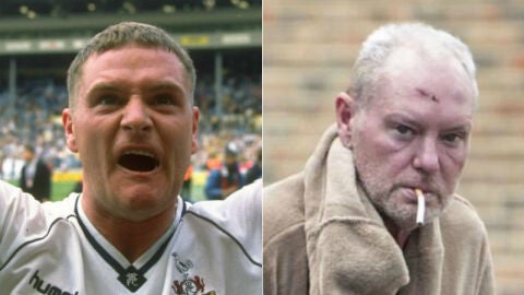 El antes y el despu&eacute;s de Paul Gascoigne