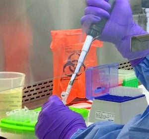Vacuna virus Zika Vacuna virus Zika