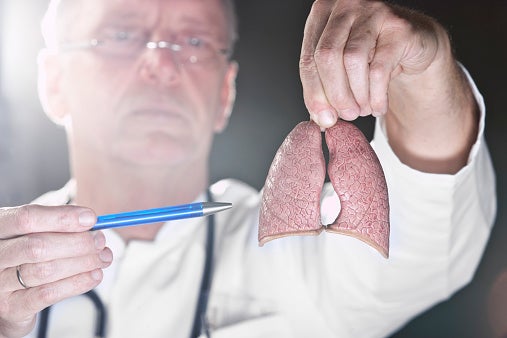 La agresividad del cáncer de pulmón es también su talón de Aquiles La agresividad del cáncer de pulmón es también su talón de Aquiles