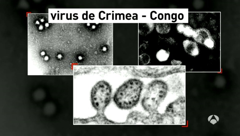 Virus Crimea Congo