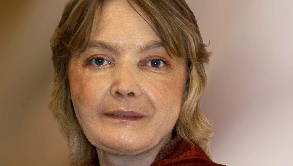 Isabelle Dinoire, la mujer francesa sometida en 2005 al primer trasplante parcial de cara del mundo