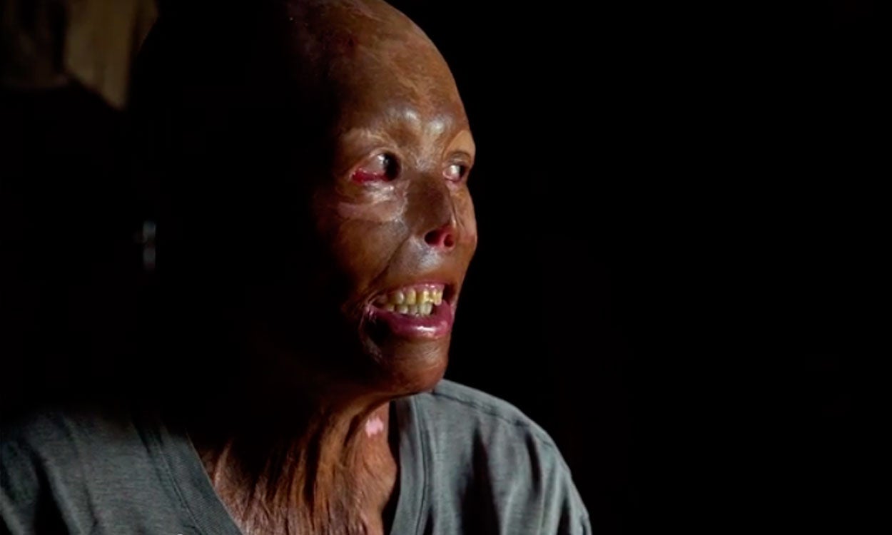 Yei Yang, un hombre víctima de una bomba "olvidada" en Laos Yei Yang, un hombre víctima de una bomba "olvidada" en Laos