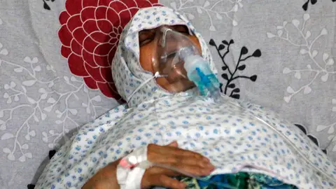 Una mujer respira con una máscara de oxígeno en un hospital de Alepo tras un posible ataque de gas cloro Una mujer respira con una máscara de oxígeno en un hospital de Alepo tras un posible ataque de gas cloro