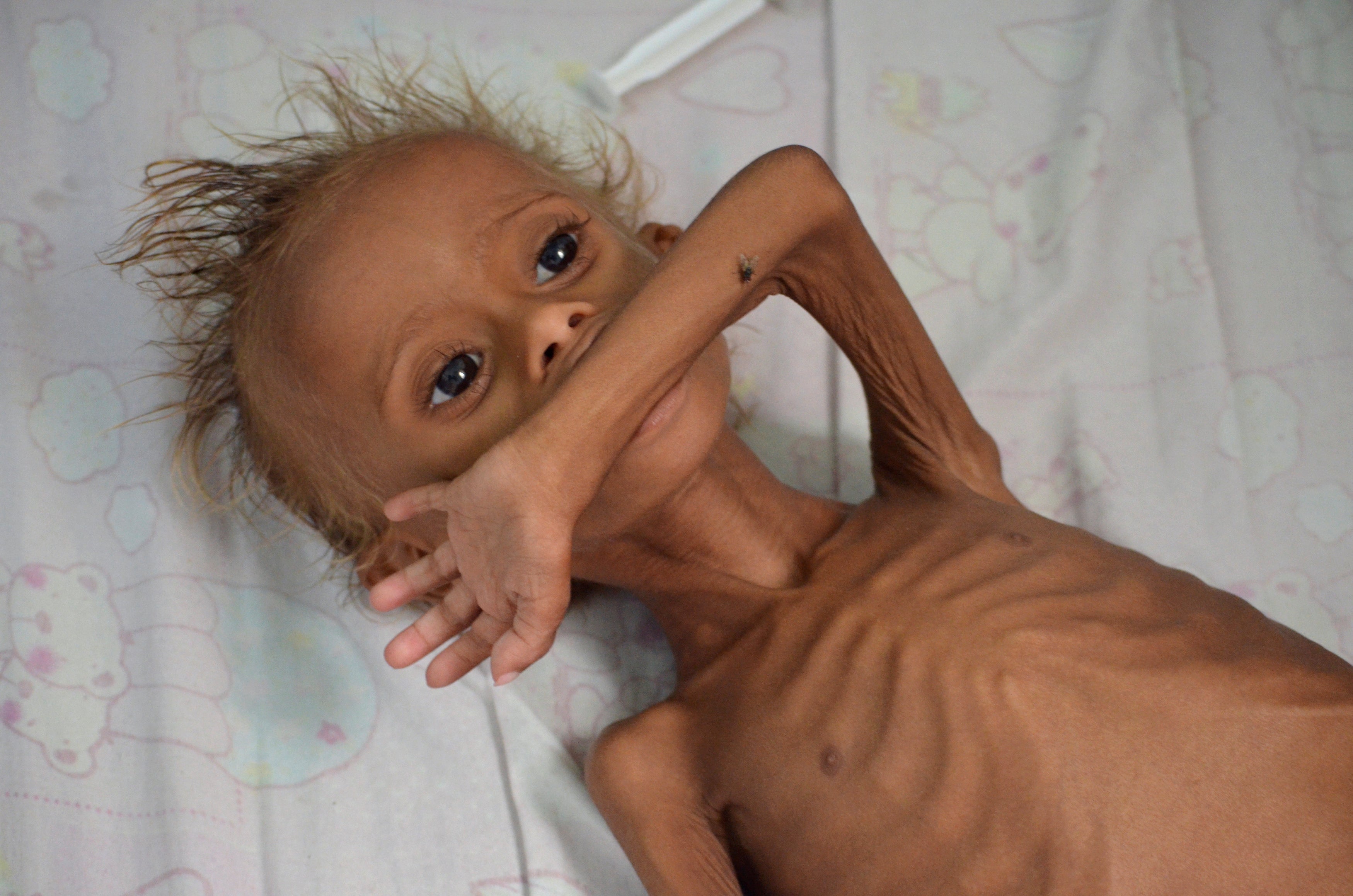 Yemen sufrirá una hambruna en 2017 si no se acelera la llegada de ayuda Yemen sufrirá una hambruna en 2017 si no se acelera la llegada de ayuda