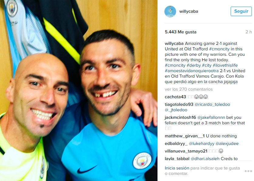 Kolarov pierde un diente en el derbi de Manchester Kolarov pierde un diente en el derbi de Manchester