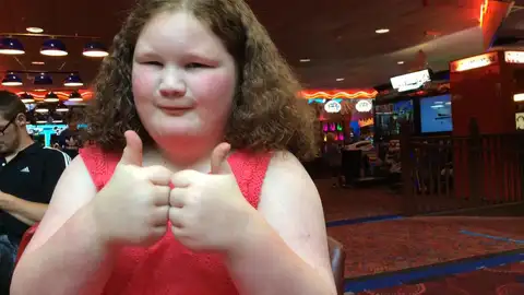 Niña con el extraño síndrome por el que tiene siempre hambre Niña con el extraño síndrome por el que tiene siempre hambre