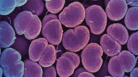 Neisseria gonorrhoeae, la bacteria que provoca la gonorrea Neisseria gonorrhoeae, la bacteria que provoca la gonorrea