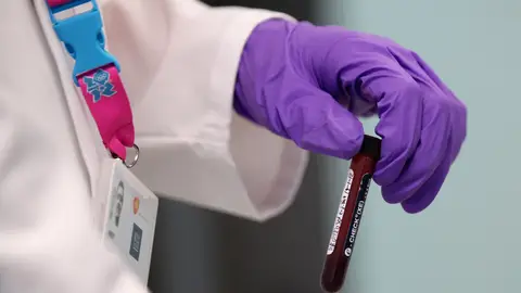 Control antidopaje Control antidopaje