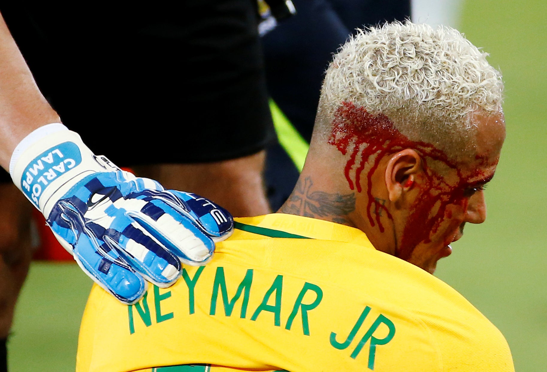 Neymar acabó con la cara ensangrentada tras un codazo de Duk Neymar acabó con la cara ensangrentada tras un codazo de Duk