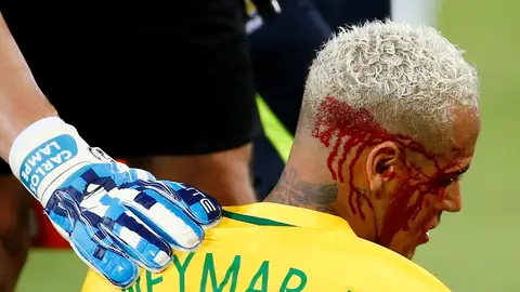 Neymar, con el rostro ensangrentado tras recibir un codazo Neymar, con el rostro ensangrentado tras recibir un codazo