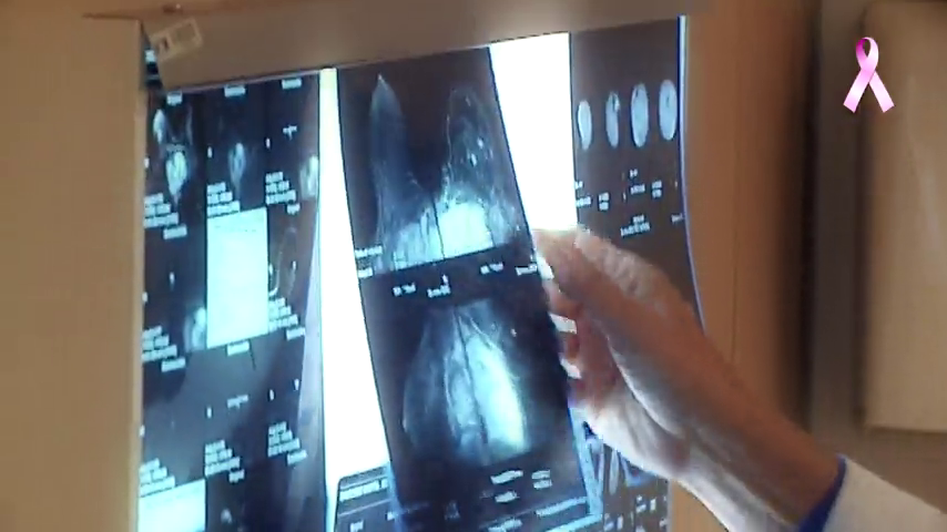 El SES incorporará una nueva aplicación para realizar el seguimiento del programa de cribado y detección del cáncer de mama El SES incorporará una nueva aplicación para realizar el seguimiento del programa de cribado y detección del cáncer de mama