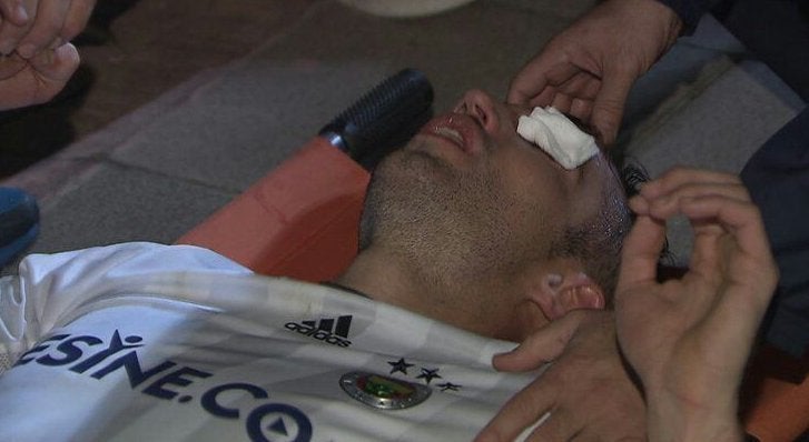 Van Persie: "Mi ojo está a salvo, sólo es un pequeño corte en el párpado" Van Persie: "Mi ojo está a salvo, sólo es un pequeño corte en el párpado"
