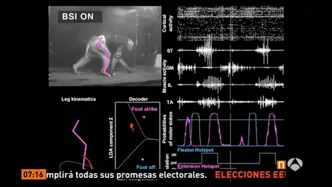 Un mono con parálisis vuelve a caminar gracias a un chip Un mono con parálisis vuelve a caminar gracias a un chip