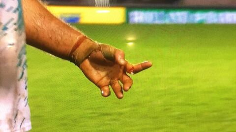 Escalofriante lesi&oacute;n de un jugador de rugby
