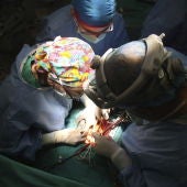 Un quirófano durante un trasplante