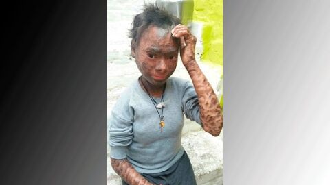 Ni&ntilde;a serpiente
