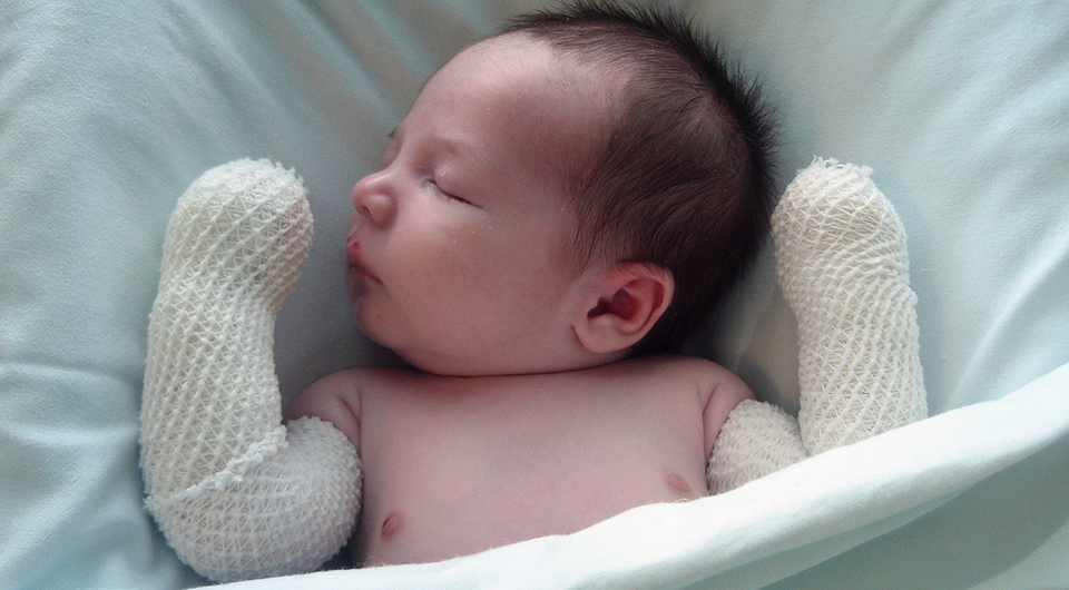 Debra Piel de Mariposa pone en marcha una campaña de concienciación y de recogida de fondos para contratar a un psicólogo Debra Piel de Mariposa pone en marcha una campaña de concienciación y de recogida de fondos para contratar a un psicólogo