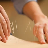 La acupuntura es un elemento clave en la medicina tradicional china. La acupuntura es un elemento clave en la medicina tradicional china.