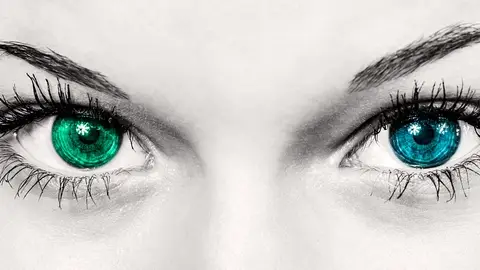 Ojos Ojos