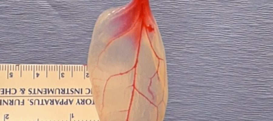 Las espinacas podrían remplazar el tejido vascular humano Las espinacas podrían remplazar el tejido vascular humano