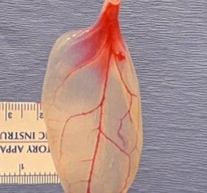 Las espinacas podrían remplazar el tejido vascular humano Las espinacas podrían remplazar el tejido vascular humano