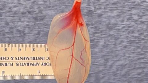 Las espinacas podr&iacute;an remplazar el tejido vascular humano