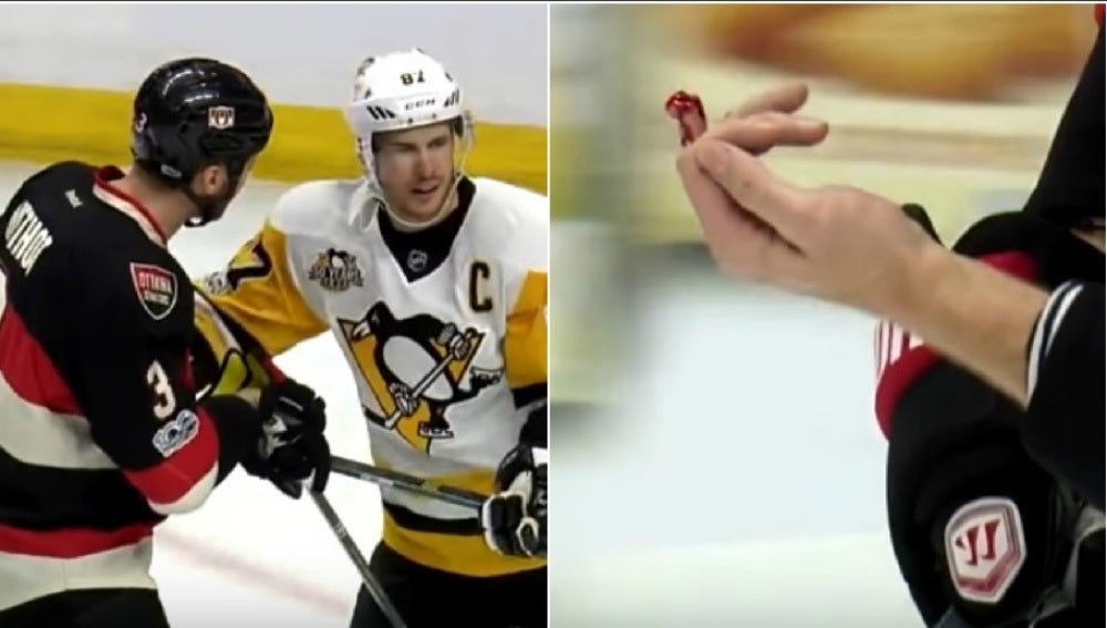Corte en un dedo en un partido de la NHL